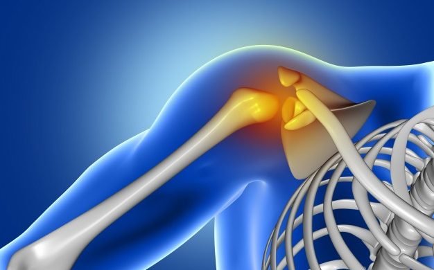 arthritis joint pain